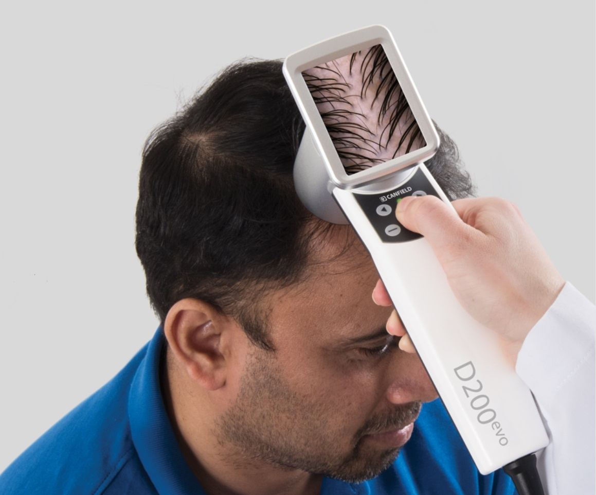 Equipamento HairMetrix® Canfield D200evo — Diagnóstico capilar de alta definição